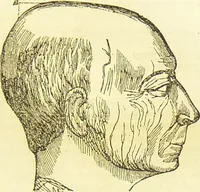 Picture 23 of 58 from New illustrated self-instructor in phrenology and physiology : together with the chart and character of ... as marked by ... / by O.S. and L.N. Fowler. (1877), leaf 73