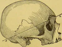 An illustration from The natural history of the human temperaments : their laws in relation to marriage, and the fatal consequences of their violation to progeny, with the indications of vigorous life and longevity : followed by a fugitive essay on the protection of society against crime / by W. Byrd Powell. (1869)