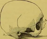 An illustration from The natural history of the human temperaments : their laws in relation to marriage, and the fatal consequences of their violation to progeny, with the indications of vigorous life and longevity : followed by a fugitive essay on the protection of society against crime / by W. Byrd Powell. (1869)
