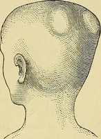Picture 32 of 40 from How to teach according to temperament and mental development or : Phrenology in the school-room and the family / by Nelson Sizer. (1877), leaf 259