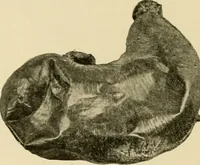 An illustration from Pediatrics : the hygienic and medical treatment of children / by Thomas Morgan Rotch. (1898)