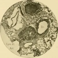 An illustration from Pediatrics : the hygienic and medical treatment of children / by Thomas Morgan Rotch. (1898)