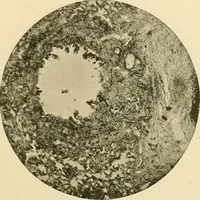 An illustration from Pediatrics : the hygienic and medical treatment of children / by Thomas Morgan Rotch. (1898)
