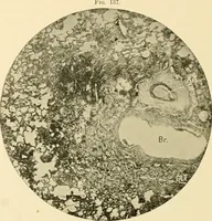 An illustration from Pediatrics : the hygienic and medical treatment of children / by Thomas Morgan Rotch. (1898)