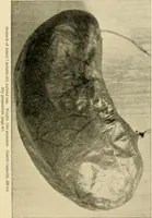 An illustration from Pediatrics : the hygienic and medical treatment of children / by Thomas Morgan Rotch. (1898)