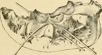 An illustration from Pediatrics : the hygienic and medical treatment of children / by Thomas Morgan Rotch. (1898)