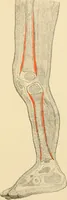 An illustration from Pediatrics : the hygienic and medical treatment of children / by Thomas Morgan Rotch. (1898)
