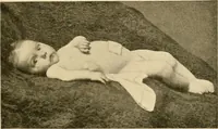 An illustration from Pediatrics : the hygienic and medical treatment of children / by Thomas Morgan Rotch. (1898)