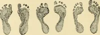An illustration from Pediatrics : the hygienic and medical treatment of children / by Thomas Morgan Rotch. (1898)