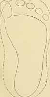 An illustration from Pediatrics : the hygienic and medical treatment of children / by Thomas Morgan Rotch. (1898)