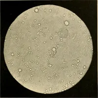 An illustration from Pediatrics : the hygienic and medical treatment of children / by Thomas Morgan Rotch. (1898)