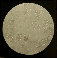 An illustration from Pediatrics : the hygienic and medical treatment of children / by Thomas Morgan Rotch. (1898)