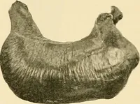 An illustration from Pediatrics : the hygienic and medical treatment of children / by Thomas Morgan Rotch. (1898)