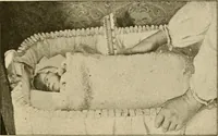 An illustration from Pediatrics : the hygienic and medical treatment of children / by Thomas Morgan Rotch. (1898)