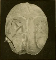 An illustration from Pediatrics : the hygienic and medical treatment of children / by Thomas Morgan Rotch. (1898)