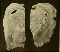 An illustration from Pediatrics : the hygienic and medical treatment of children / by Thomas Morgan Rotch. (1898)