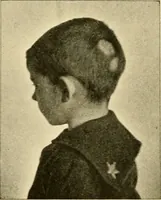 An illustration from Pediatrics : the hygienic and medical treatment of children / by Thomas Morgan Rotch. (1898)
