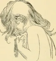 An illustration from Pediatrics : the hygienic and medical treatment of children / by Thomas Morgan Rotch. (1898)