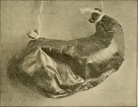 An illustration from Pediatrics : the hygienic and medical treatment of children / by Thomas Morgan Rotch. (1898)