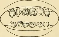 An illustration from Pediatrics : the hygienic and medical treatment of children / by Thomas Morgan Rotch. (1898)
