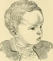 Picture 90 of 203 from Pediatrics : the hygienic and medical treatment of children / by Thomas Morgan Rotch. (1898), leaf 560