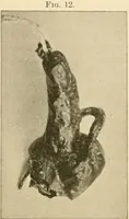 Picture 5 of 203 from Pediatrics : the hygienic and medical treatment of children / by Thomas Morgan Rotch. (1898), leaf 57