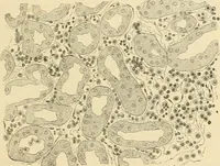 An illustration from Pediatrics : the hygienic and medical treatment of children / by Thomas Morgan Rotch. (1898)