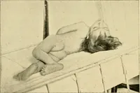 An illustration from Pediatrics : the hygienic and medical treatment of children / by Thomas Morgan Rotch. (1898)