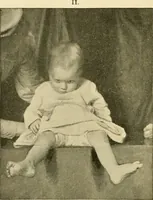 An illustration from Pediatrics : the hygienic and medical treatment of children / by Thomas Morgan Rotch. (1898)