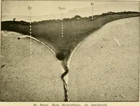 Picture 115 of 203 from Pediatrics : the hygienic and medical treatment of children / by Thomas Morgan Rotch. (1898), leaf 707