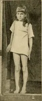 An illustration from Pediatrics : the hygienic and medical treatment of children / by Thomas Morgan Rotch. (1898)