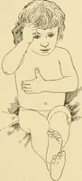 An illustration from Pediatrics : the hygienic and medical treatment of children / by Thomas Morgan Rotch. (1898)