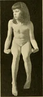 An illustration from Pediatrics : the hygienic and medical treatment of children / by Thomas Morgan Rotch. (1898)
