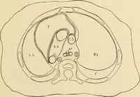 An illustration from Pediatrics : the hygienic and medical treatment of children / by Thomas Morgan Rotch. (1898)
