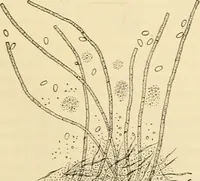 An illustration from Pediatrics : the hygienic and medical treatment of children / by Thomas Morgan Rotch. (1898)