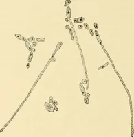 An illustration from Pediatrics : the hygienic and medical treatment of children / by Thomas Morgan Rotch. (1898)