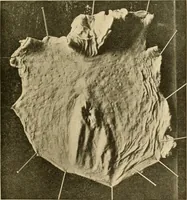 An illustration from Pediatrics : the hygienic and medical treatment of children / by Thomas Morgan Rotch. (1898)