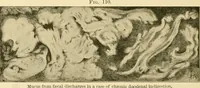 Picture 133 of 203 from Pediatrics : the hygienic and medical treatment of children / by Thomas Morgan Rotch. (1898), leaf 928