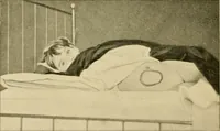 An illustration from Pediatrics : the hygienic and medical treatment of children / by Thomas Morgan Rotch. (1898)
