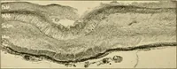 Picture 146 of 203 from Pediatrics : the hygienic and medical treatment of children / by Thomas Morgan Rotch. (1898), leaf 968