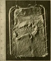 Picture 153 of 203 from Pediatrics : the hygienic and medical treatment of children / by Thomas Morgan Rotch. (1898), leaf 986