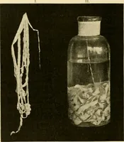 An illustration from Pediatrics : the hygienic and medical treatment of children / by Thomas Morgan Rotch. (1898)