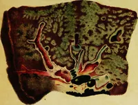 An illustration from Illustrations of pulmonary consumption : its anatomical characters, causes, symptoms and treatment. With twelve plates, drawn and coloured from nature / By Samuel George Morton. (1834)