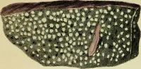 An illustration from Illustrations of pulmonary consumption : its anatomical characters, causes, symptoms and treatment. With twelve plates, drawn and coloured from nature / By Samuel George Morton. (1834)