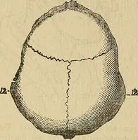 An illustration from Questioni filosofiche, sociali, mediche e medico-forensi : trattate coi principii della fisiologia del cervello / pel Dottore Biagio G. Miraglia. (1883)