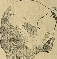 An illustration from Questioni filosofiche, sociali, mediche e medico-forensi : trattate coi principii della fisiologia del cervello / pel Dottore Biagio G. Miraglia. (1883)