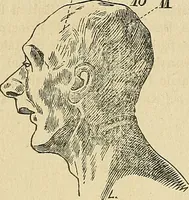 An illustration from Questioni filosofiche, sociali, mediche e medico-forensi : trattate coi principii della fisiologia del cervello / pel Dottore Biagio G. Miraglia. (1883)