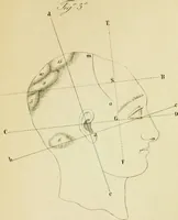 An illustration from Cenno su di una nuova classificazione e di una nuova statistica delle alienazioni mentali, fondate su principì frenologici considerati nei loro rapporti con la patologia del cervello, del Biagio G. Miraglia. (1847)