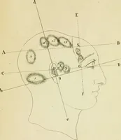 An illustration from Cenno su di una nuova classificazione e di una nuova statistica delle alienazioni mentali, fondate su principì frenologici considerati nei loro rapporti con la patologia del cervello, del Biagio G. Miraglia. (1847)
