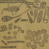 Picture 26 of 163 from The origin of life and process of reproduction in plants and animals : with the anatomy and physiology of the human generative system, male and female, and the causes, prevention and cure of the special diseases to which it is liable : a plain, practical treatise, for popular use / by Dr. F. Hollick ; illustrated by engravings and colored plates. (1902), leaf 115